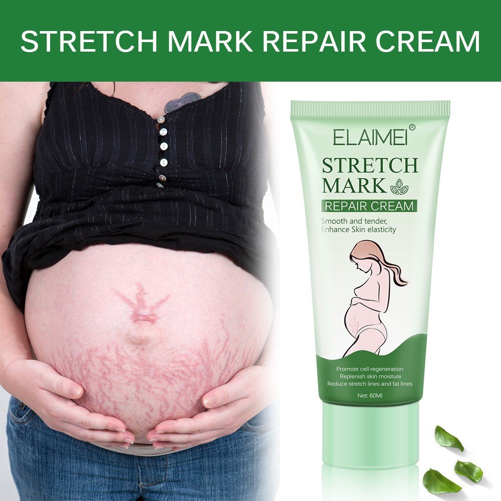 Stretch Mark Repair Cream - Help Yourself