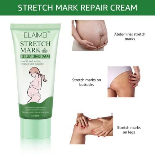 Stretch Mark Repair Cream - Image 7